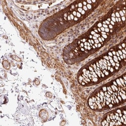 ATP6AP1L Antibody, Novus Biologicals:Antibodies:Primary Antibodies